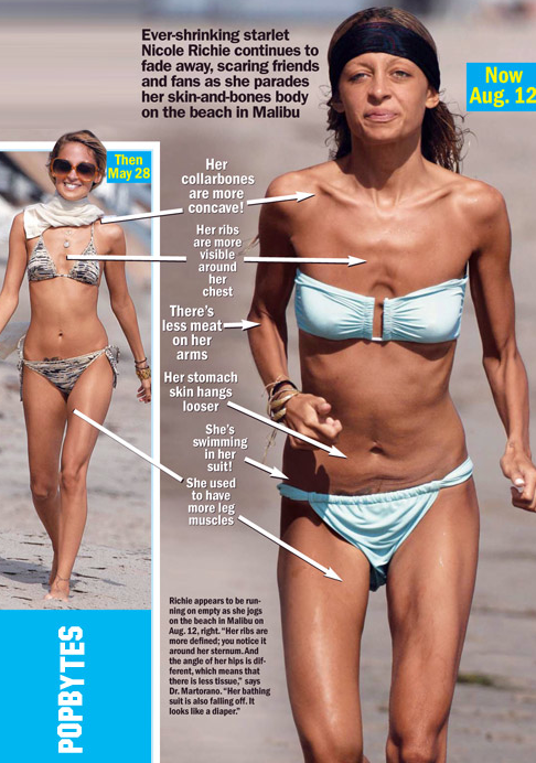 You Suspect Your Friend Has An Eating Disorder, But She Claims She Is Perfectly Healthy. . .